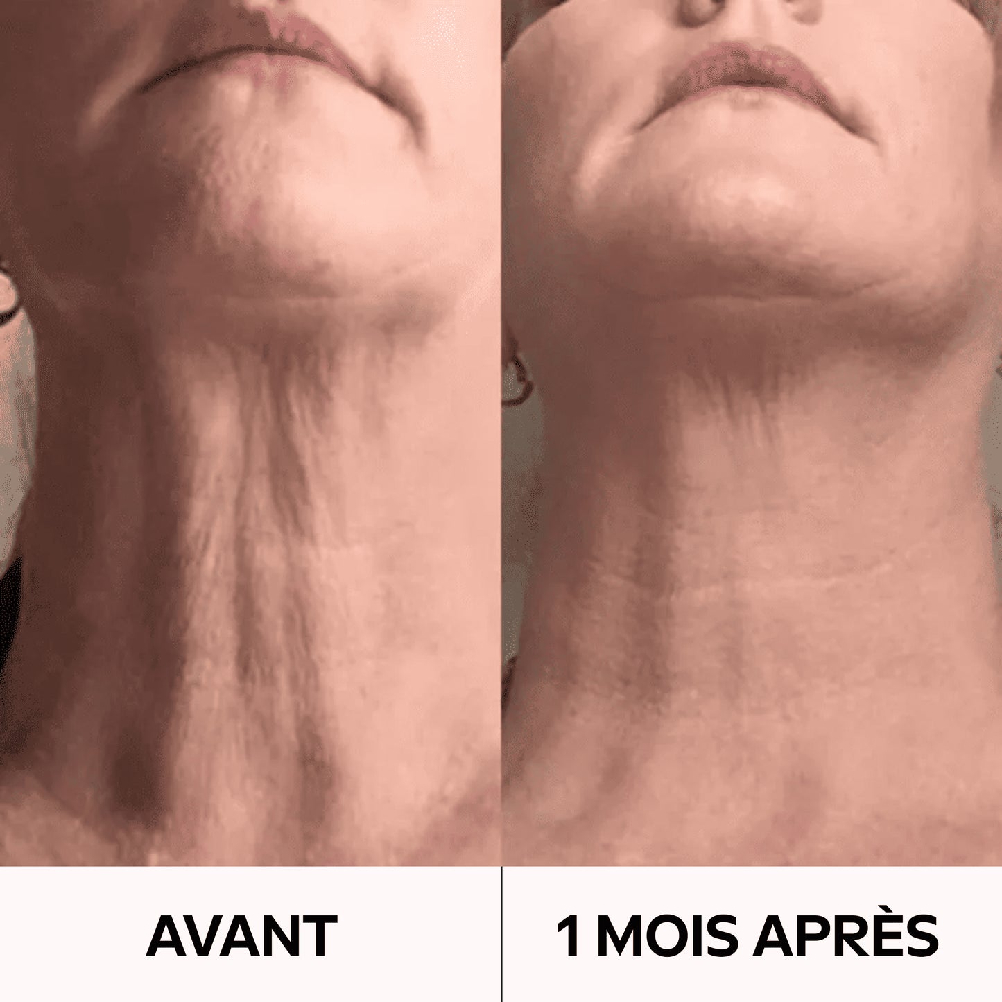 Retrouvez un Cou Visiblement Plus Jeune en Seulement 3 Heures ! GN