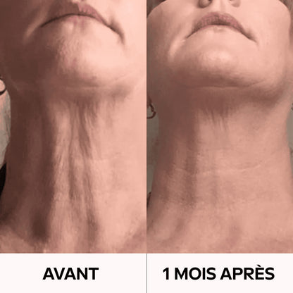 Retrouvez un Cou Visiblement Plus Jeune en Seulement 3 Heures ! GN