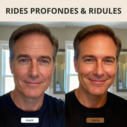 ForceSkin - Crème Anti-Rides CI