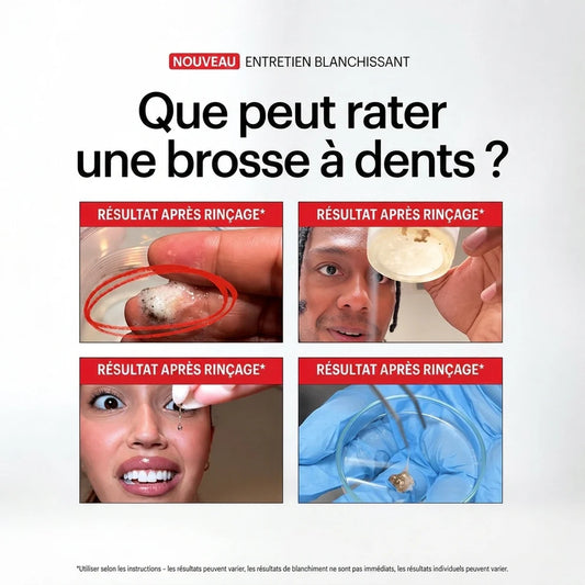 iD | Découvrez ce qui se cache vraiment sur vos dents  Bain de bouche Japonais 🦷 BF
