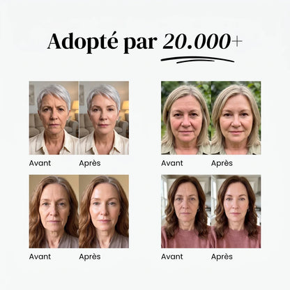 Combleur de rides instantané BF