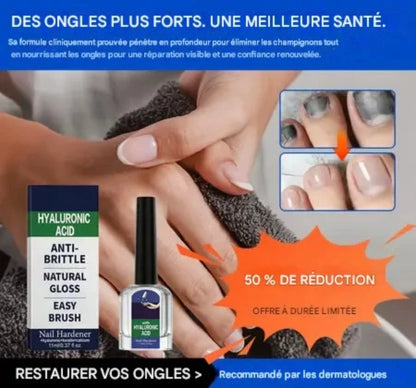 Solution antifongique pour la réparation des ongles GN