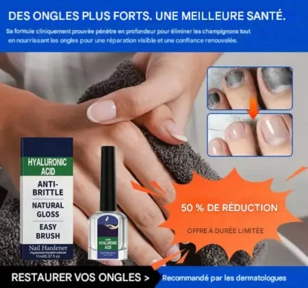 Solution antifongique pour la réparation des ongles CMD